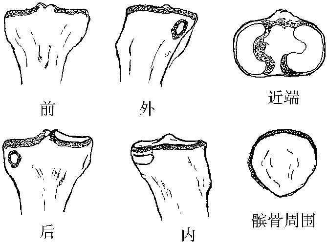 第三節(jié) 膝關(guān)節(jié)滑膜炎